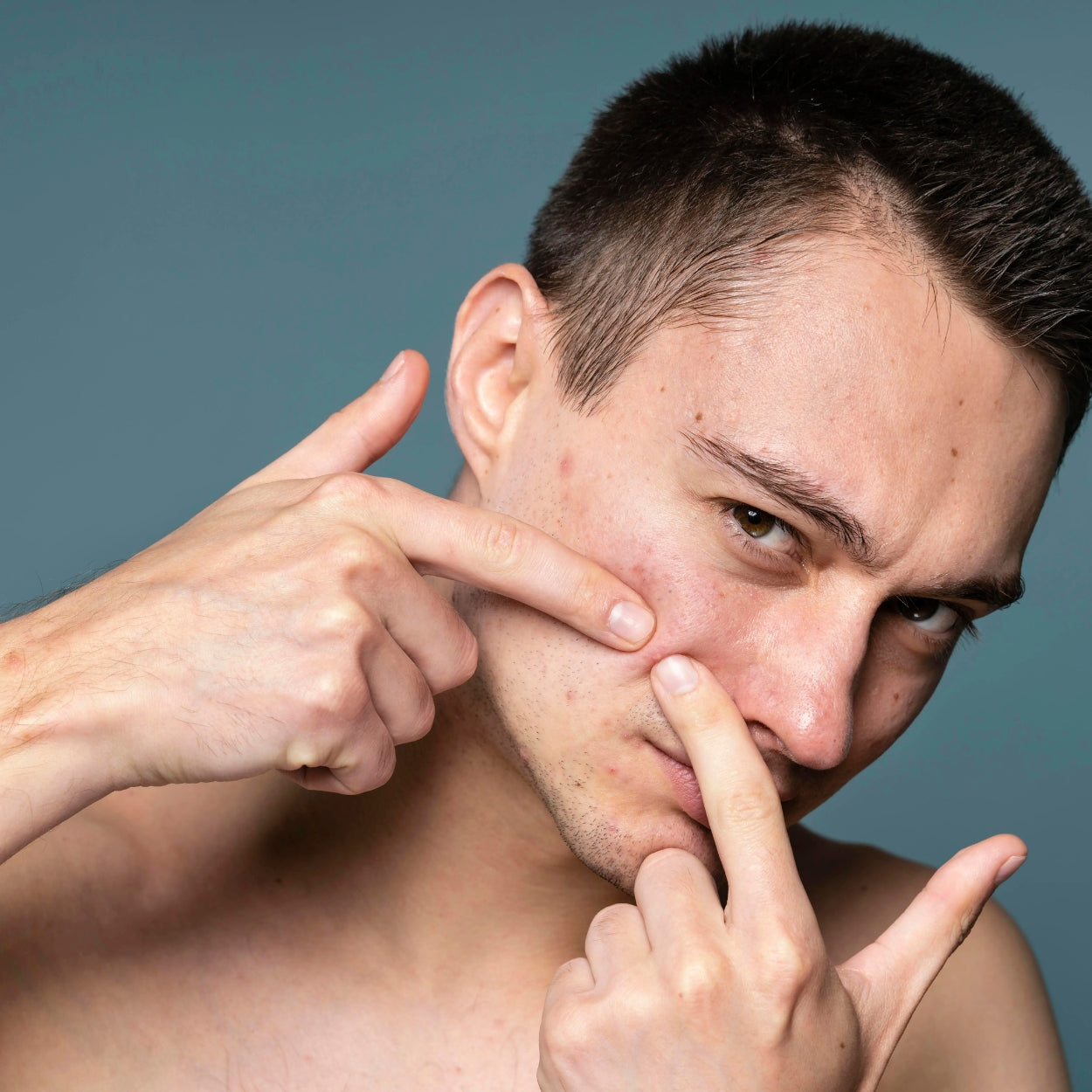 Il n’est pas trop tard pour ta peau.